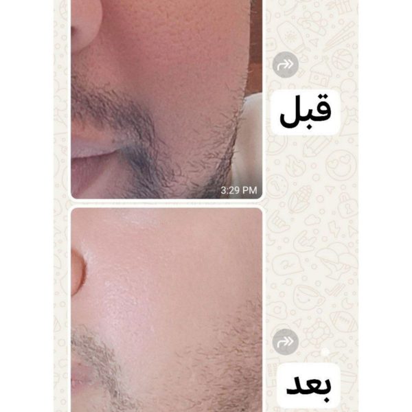 الرئيسية راي9